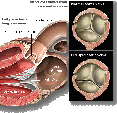 Heart Diagram Bicuspid Valve. Home middot; About; coding