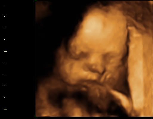 BABY_10.jpg