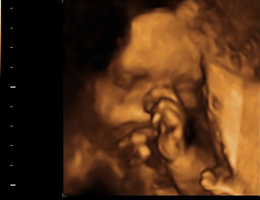 BABY_7.jpg