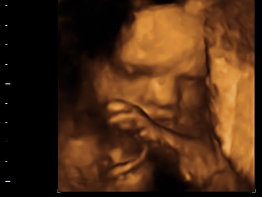 BABY_8.jpg