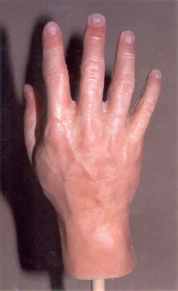 ProstheticHand1.jpg