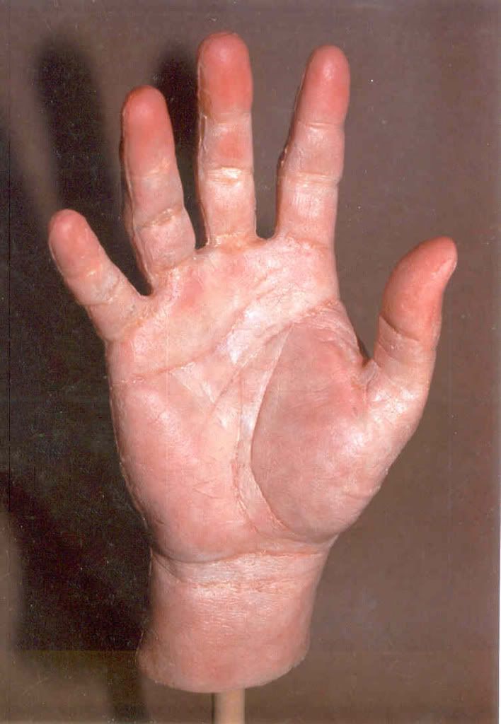 ProstheticHand2.jpg