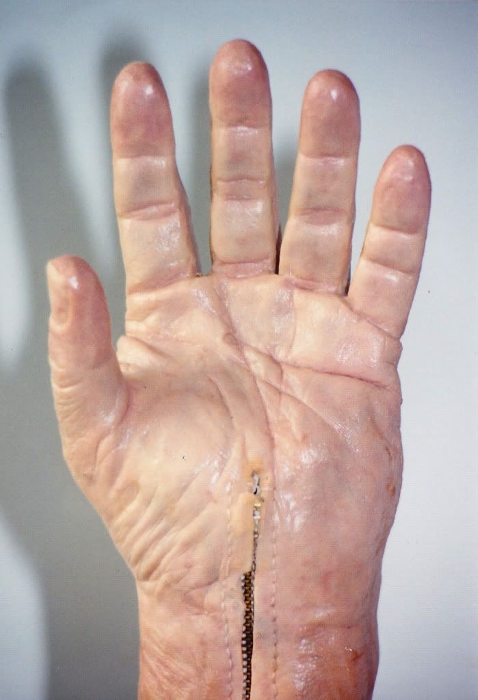 ProstheticHand4.jpg